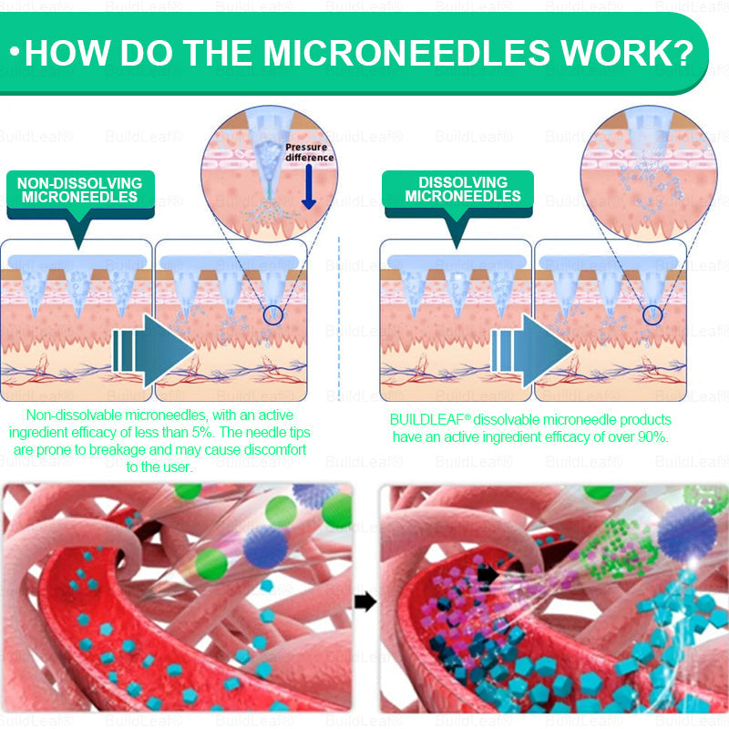 Official Store🏥 | BuildLeaf® GLP-1 Nano-Microneedle Patch with Collagen & Matrixyl 3000 丨Obesity,Cardiovascular Diseas, Diabetes, Sleep Apnea, Joint Problems and More