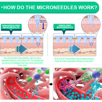 Official Store🏥 | BuildLeaf® GLP-1 Nano-Microneedle Patch with Collagen & Matrixyl 3000 丨Obesity,Cardiovascular Diseas, Diabetes, Sleep Apnea, Joint Problems and More